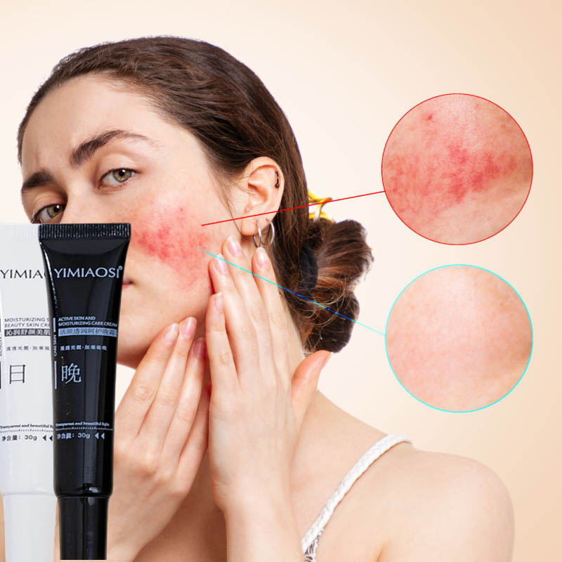 Coenzyme Q10 Cream - Facial Redness Repair Cream Improve Sensitive