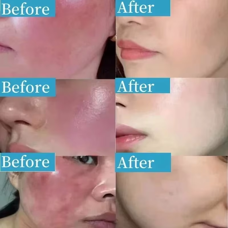 Korean Facial Redness Repair C - đánh giá và giá Coenzyme Q10 Cream