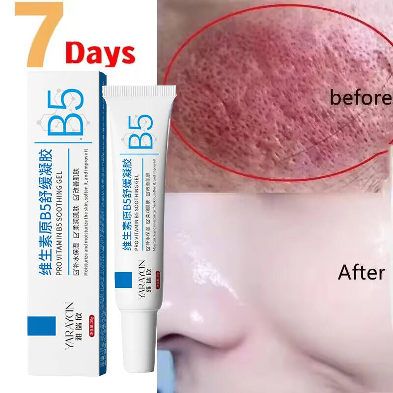 Facial Redness Repair Cream Im - đánh giá và giá Coenzyme Q10 Cream