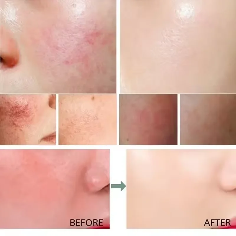 Facial Redness Repair Cream Im - đánh giá và giá Coenzyme Q10 Cream