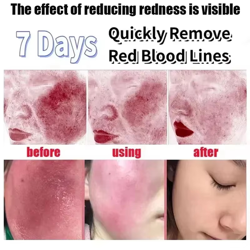 Facial Redness Repair Cream Im - đánh giá và giá Coenzyme Q10 Cream
