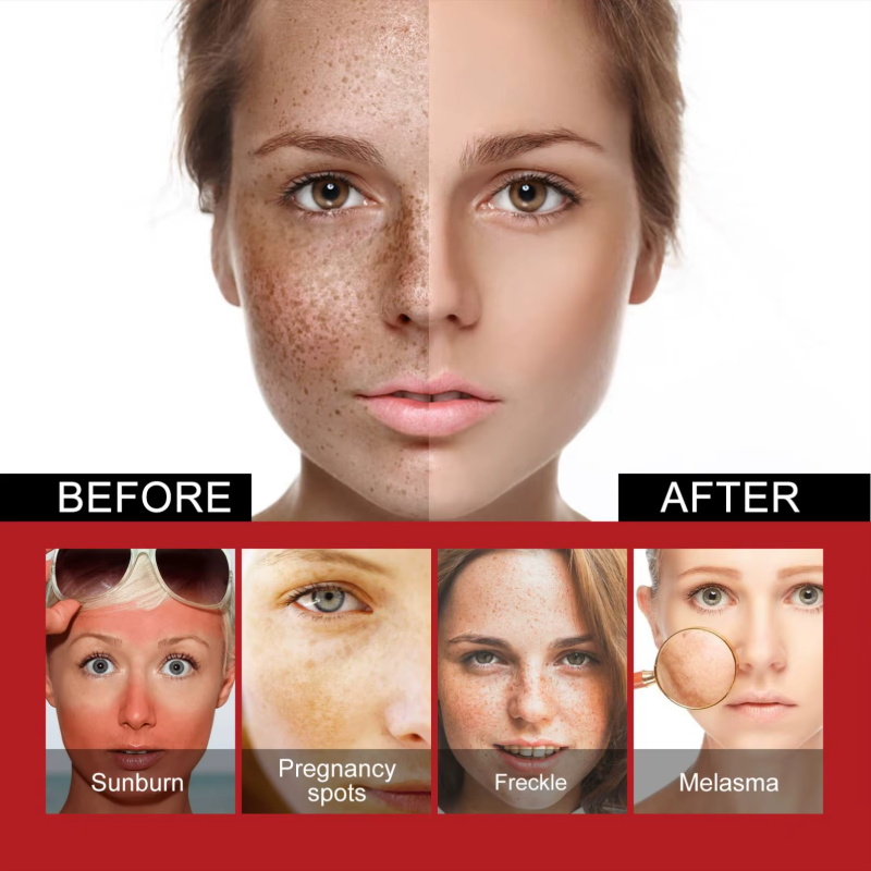 Powerful Spot-Removing Whiten  - đánh giá và giá Coenzyme Q10 Cream