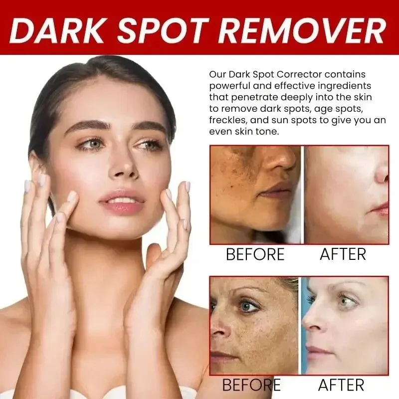 Powerful Spot-Removing Whiten  - đánh giá và giá Coenzyme Q10 Cream